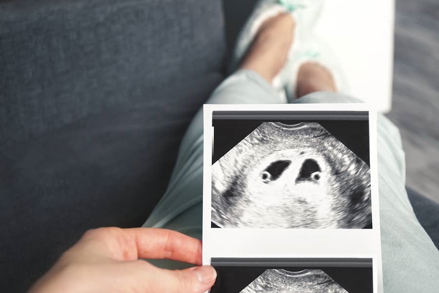 ontwikkeling baby 4 weken